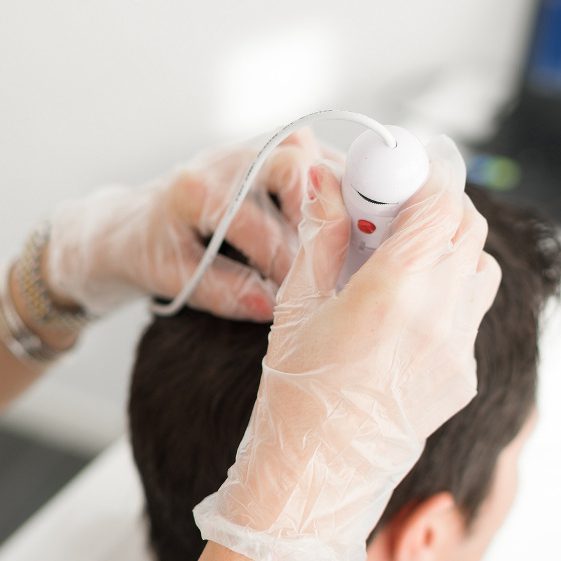 Tratamiento1 Verona, Italy - April 15, 2016: Analysis of the health of the hair done in a trichological center.