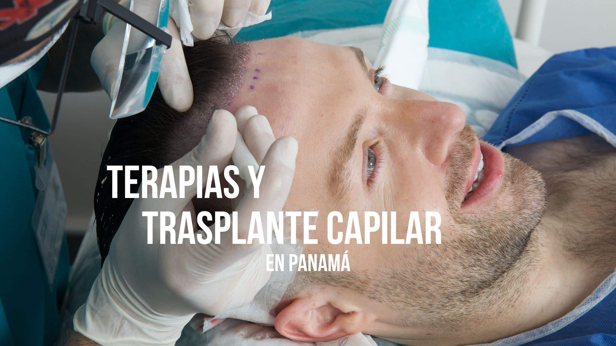 Terapias y Trasplantes Capilares en Panamá