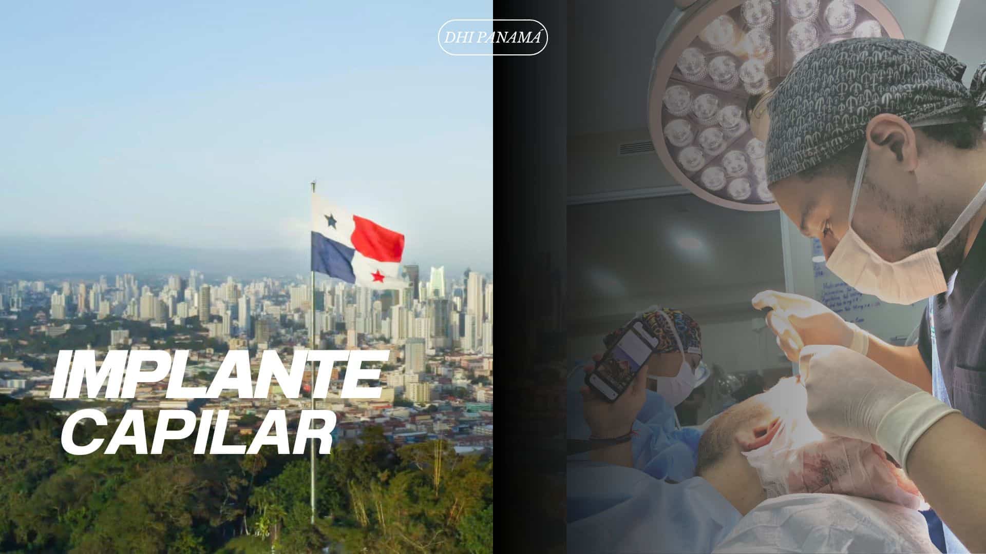 Panamá como la opción ideal para el implante de cabello