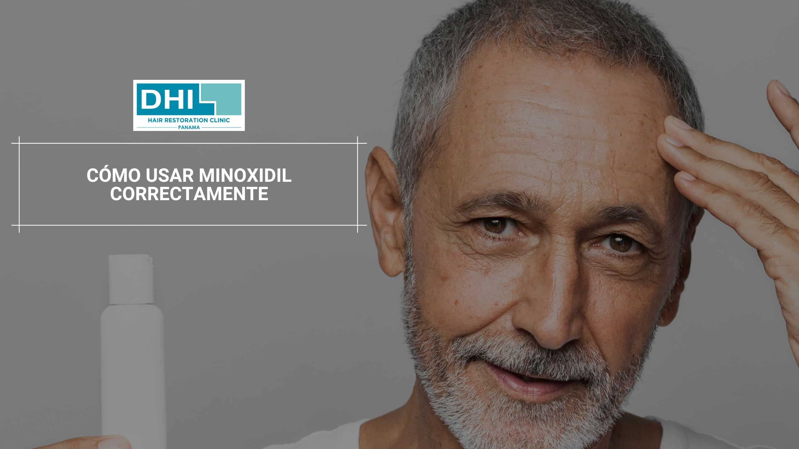 Cómo Usar Minoxidil Correctamente