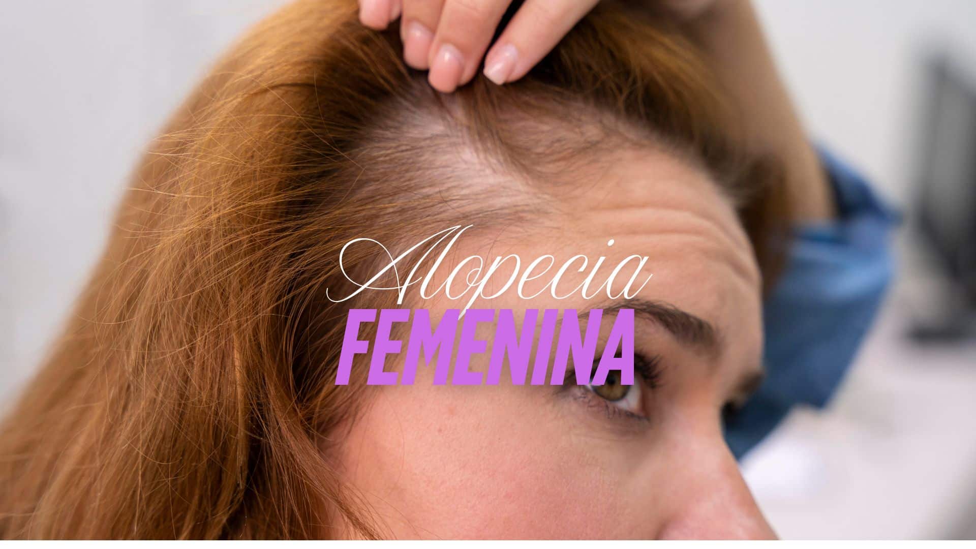 Cómo Prevenir la Caída del Cabello