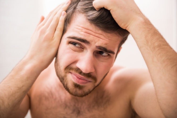 Caída del cabello en jóvenes