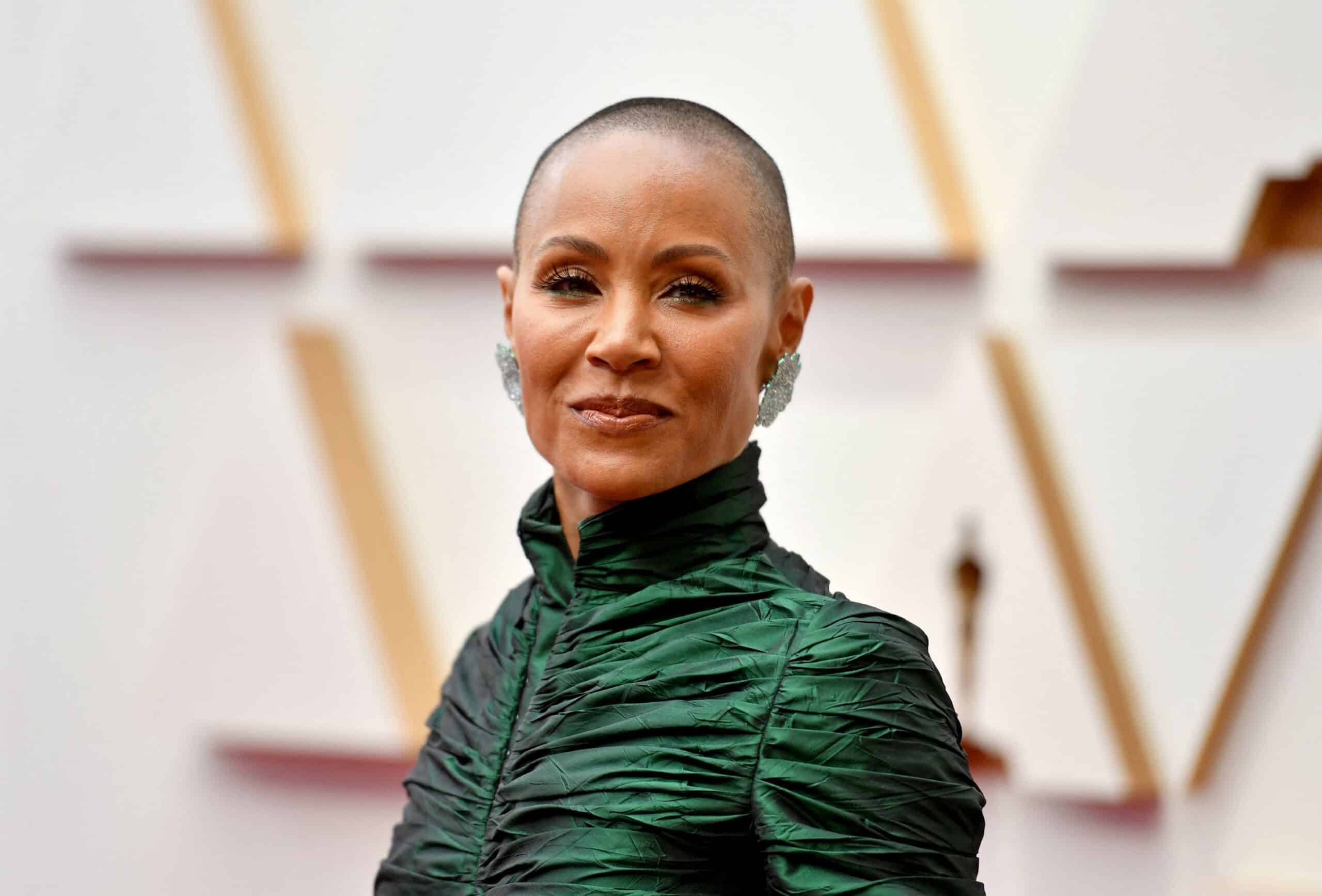 Alopecia femenina soluciones