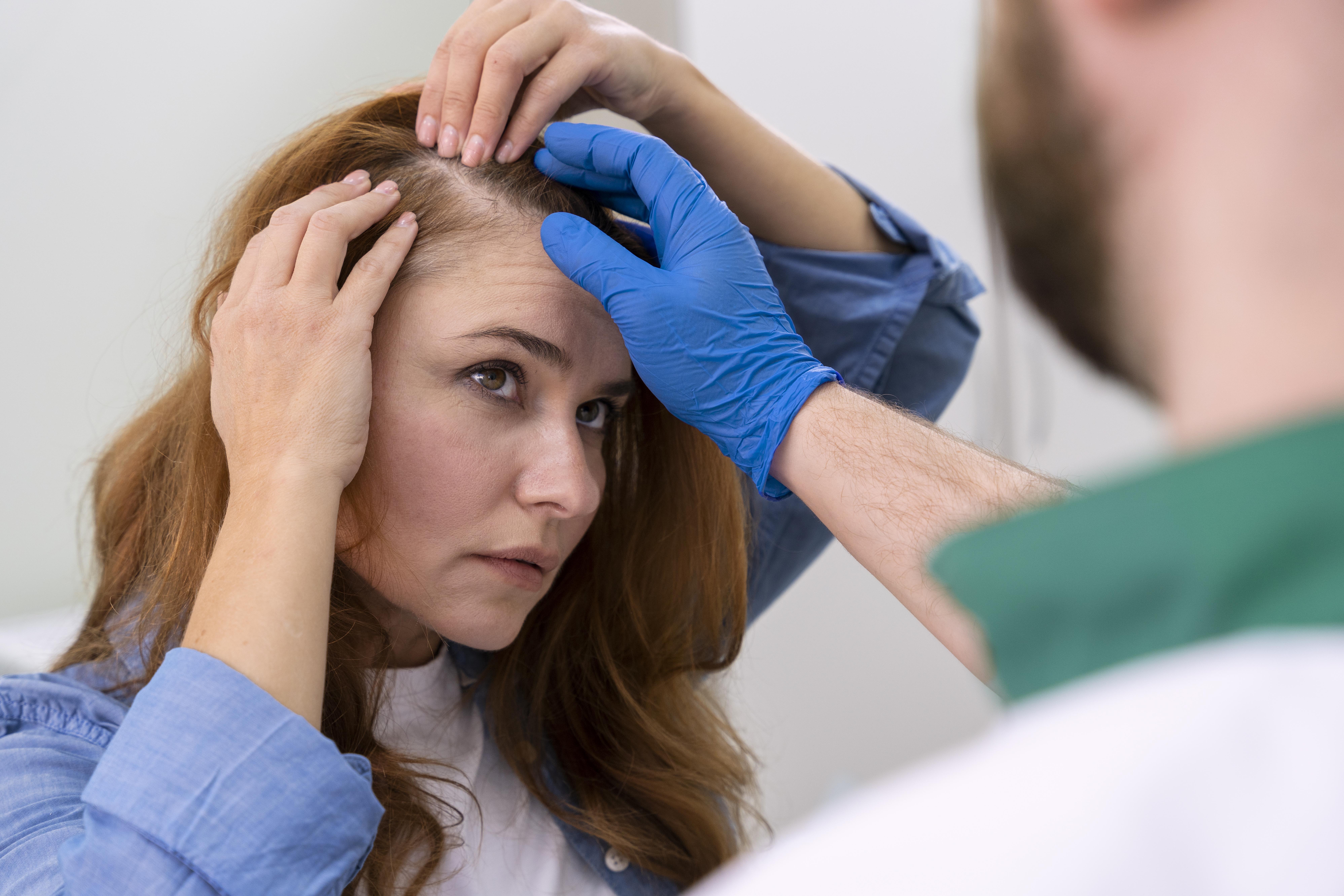 Cómo Prevenir la alopecia femenina